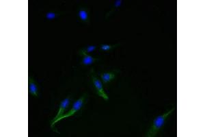Immunofluorescent analysis of Hela cells using ABIN7169852 at dilution of 1:100 and Alexa Fluor 488-congugated AffiniPure Goat Anti-Rabbit IgG(H+L) (SMIM14 Antikörper  (AA 1-49))