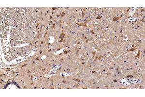 Detection of AST2 in Rat Spinal cord Tissue using Polyclonal Antibody to Aspartate Aminotransferase 2 (AST2) (AST2 (AA 30-430) Antikörper)