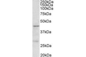 Western Blotting (WB) image for anti-Protein Arginine Methyltransferase 6 (PRMT6) (Internal Region) antibody (ABIN1108736) (PRMT6 Antikörper  (Internal Region))