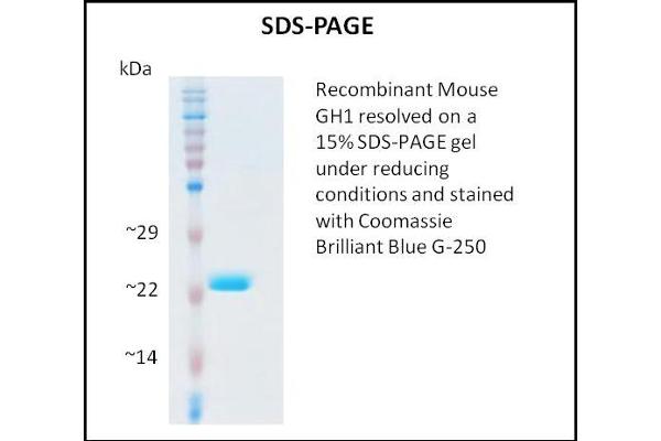 Growth Hormone 1 Protein (GH1)