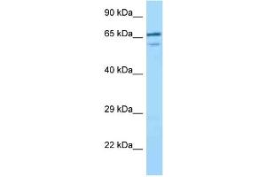 WB Suggested Anti-VILL Antibody Titration: 1. (VILL Antikörper  (C-Term))