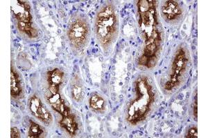 Image no. 1 for anti-ATP-Binding Cassette, Sub-Family B (MDR/TAP), Member 1 (ABCB1) (AA 347-710) antibody (ABIN1491433) (ABCB1 Antikörper  (AA 347-710))