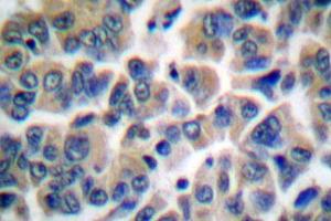 Image no. 2 for anti-Friend Leukemia Virus Integration 1 (FLI1) antibody (ABIN265422) (FLI1 Antikörper)