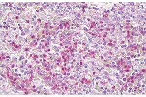 Anti-CSF2RB / CD131 antibody IHC staining of human spleen, neutrophils. (CD131 Antikörper  (AA 559-608))