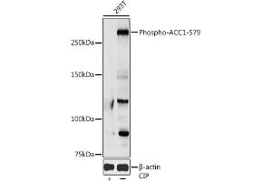 Western blot analysis of extracts of 293T cells, using Phospho--S79 antibody (ABIN3020066, ABIN3020067, ABIN3020068 and ABIN1681361) at 1:1000 dilution.