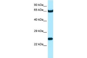 WB Suggested Anti-STXBP3 Antibody Titration: 1. (STXBP3 Antikörper  (C-Term))
