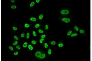 Immunofluorescence analysis of U2OS cells using MCM6 Polyclonal Antibody