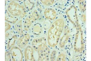 Immunohistochemistry of paraffin-embedded human kidney tissue using ABIN7143736 at dilution of 1:100 (FUT6 Antikörper  (AA 170-359))
