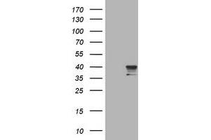 Image no. 1 for anti-Sialidase 1 (Lysosomal Sialidase) (NEU1) (AA 48-315) antibody (ABIN1491550) (NEU1 Antikörper  (AA 48-315))