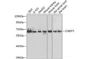 Western blot analysis of extracts of various cell lines using CNDP1 Polyclonal Antibody at dilution of 1:1000. (CNDP1 Antikörper)