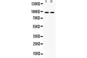Western blot analysis of Caldesmon expression in rat skeletal muscle extract ( Lane 1) and HELA whole cell lysates ( Lane 2).
