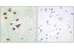 Immunohistochemistry analysis of paraffin-embedded human brain tissue, using NT5C3 Antibody. (NT5C3 Antikörper  (AA 11-60))