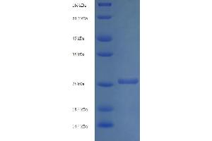 SDS-PAGE (SDS) image for ADP-Ribosylation Factor-Like 4A (ARL4A) (AA 2-200) protein (His tag) (ABIN5709079)