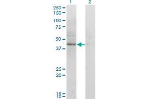 Western Blot analysis of ACAT2 expression in transfected 293T cell line by ACAT2 monoclonal antibody (M01), clone 4A5.