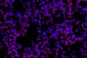 Immunofluorescent analysis of paraformaldehyde-fixed mouse lung usingp38IP (ABIN7075954) at dilution of 1: 400 (Transcription Factor SPT20 Homolog (SUPT20H) Antikörper)