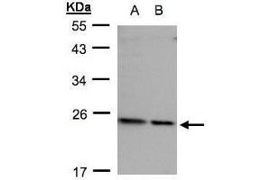 WB Image Sample(30 ug whole cell lysate) A: HeLa S3, B: Hep G2, 12% SDS PAGE diluted at 1:500 (RPL17 Antikörper)