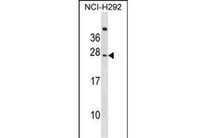 CD300C Antibody (C-term) (ABIN1536824 and ABIN2848528) western blot analysis in NCI- cell line lysates (35 μg/lane).