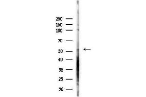 anti-Cholinergic Receptor, Nicotinic, beta 3 (Neuronal) (CHRNB3) (Internal Region) antibody