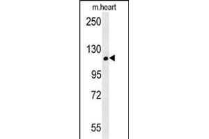 CRUM2 Antibody (C-term) (ABIN651911 and ABIN2840450) western blot analysis in mouse heart tissue lysates (15 μg/lane). (CRB2 Antikörper  (AA 1258-1285))