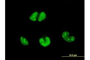 Immunofluorescence of monoclonal antibody to ESR2 on HeLa cell. (ESR2 Antikörper  (AA 22-121))