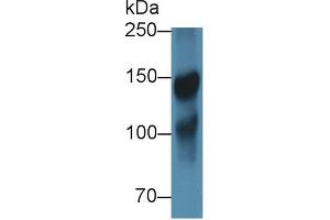 Western blot analysis of Pig Cerebrum lysate, using Rabbit Anti-Human ICAM5 Antibody (1 µg/ml) and HRP-conjugated Goat Anti-Rabbit antibody (abx400043, 0. (ICAM5 Antikörper  (AA 409-674))