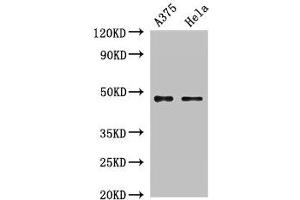 Western Blot Positive WB detected in: A375 whole cell lysate, Hela whole cell lysate All lanes: RPL4 antibody at 2 μg/mL Secondary Goat polyclonal to rabbit IgG at 1/50000 dilution Predicted band size: 48 kDa Observed band size: 48 kDa (RPL4 Antikörper  (AA 12-91))