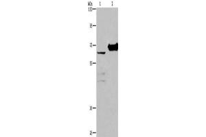 Western Blotting (WB) image for anti-Choline Dehydrogenase (CHDH) antibody (ABIN2423153) (CHDH Antikörper)