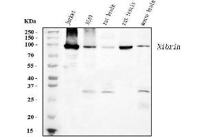 Western blot analysis of p95 NBS1 using anti-p95 NBS1 antibody (ABIN7602793).