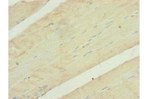 Immunohistochemistry (IHC) image for anti-Ubiquinol-Cytochrome C Reductase Core Protein I (UQCRC1) (AA 1-63) antibody (ABIN7149112)