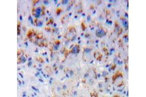 Used in DAB staining on fromalin fixed paraffin-embedded Liver tissue (CD1d Antikörper  (AA 32-302))