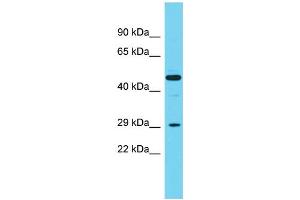 Host:  Rabbit  Target Name:  Cpa2  Sample Type:  Rat Spleen lysates  Antibody Dilution:  1.