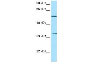 WB Suggested Anti-NCR1 Antibody Titration: 1. (NCR1 Antikörper  (C-Term))