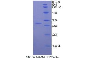 SDS-PAGE analysis of Human Myosin IG Protein.