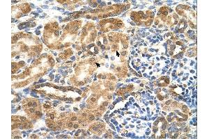 GCNT3 antibody was used for immunohistochemistry at a concentration of 4-8 ug/ml. (GCNT3 Antikörper)