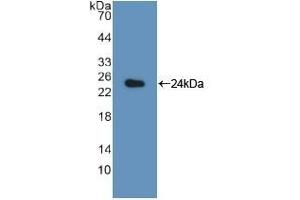 Detection of Recombinant LMP7, Rat using Polyclonal Antibody to Large Multifunctional Peptidase 7 (LMP7) (PSMB8 Antikörper  (AA 80-261))