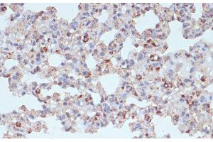 Immunohistochemistry of paraffin-embedded Rat lung using PDGFR beta Polyclonal Antibody at dilution of 1:100 (40x lens). (PDGFRB Antikörper)