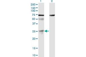 Western Blot analysis of TWSG1 expression in transfected 293T cell line by TWSG1 monoclonal antibody (M01), clone 6E6.