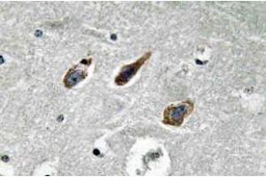 Immunohistochemistry (IHC) analyzes of Annexin II antibody in paraffin-embedded human brain tissue. (Annexin A2 Antikörper)