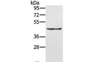 Western Blot analysis of A549 cell using KRT31 Polyclonal Antibody at dilution of 1:500 (Keratin 31 Antikörper)