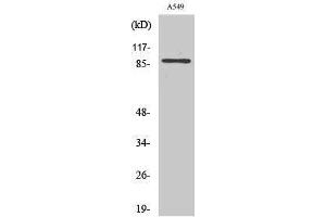 Western Blotting (WB) image for anti-Chloride Channel, Voltage-Sensitive 7 (CLCN7) (N-Term) antibody (ABIN3174436) (CLCN7 Antikörper  (N-Term))