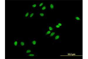 Immunofluorescence of purified MaxPab antibody to PCOLN3 on HeLa cell. (CHMP1A Antikörper  (AA 1-196))