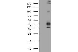 Image no. 2 for anti-Fc Fragment of IgE, Low Affinity II, Receptor For (CD23) (FCER2) (AA 48-321) antibody (ABIN1491554) (FCER2 Antikörper  (AA 48-321))