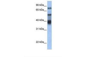 Image no. 1 for anti-Zinc Finger Protein 395 (ZNF395) (AA 218-267) antibody (ABIN6737715) (ZNF395 Antikörper  (AA 218-267))