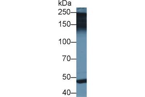 Western blot analysis of Rat Placenta lysate, using Human PAPPA2 Antibody (2 µg/ml) and HRP-conjugated Goat Anti-Rabbit antibody (