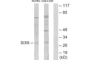 Western blot analysis of extracts from HUVEC cells and COLO205 cells, using SIX6 antibody. (SIX Homeobox 6 Antikörper  (Internal Region))