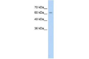 WB Suggested Anti-ALPPL2 Antibody Titration:  2. (ALPPL2 Antikörper  (N-Term))