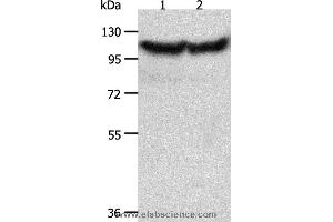Western blot analysis of Hela and NIH/3T3 cell, using ACTN3 Polyclonal Antibody at dilution of 1:300 (ACTN3 Antikörper)