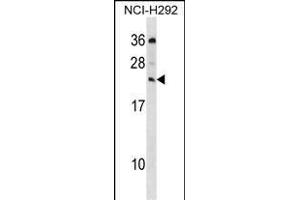MED19 Antibody (C-term) (ABIN1536757 and ABIN2850102) western blot analysis in NCI- cell line lysates (35 μg/lane). (MED19 Antikörper  (C-Term))