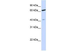 ZNF334 antibody used at 0. (ZNF334 Antikörper  (N-Term))