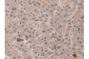 Used in DAB staining on fromalin fixed paraffin- embedded liver tissue (beta Defensin 1 Antikörper  (AA 22-69))
